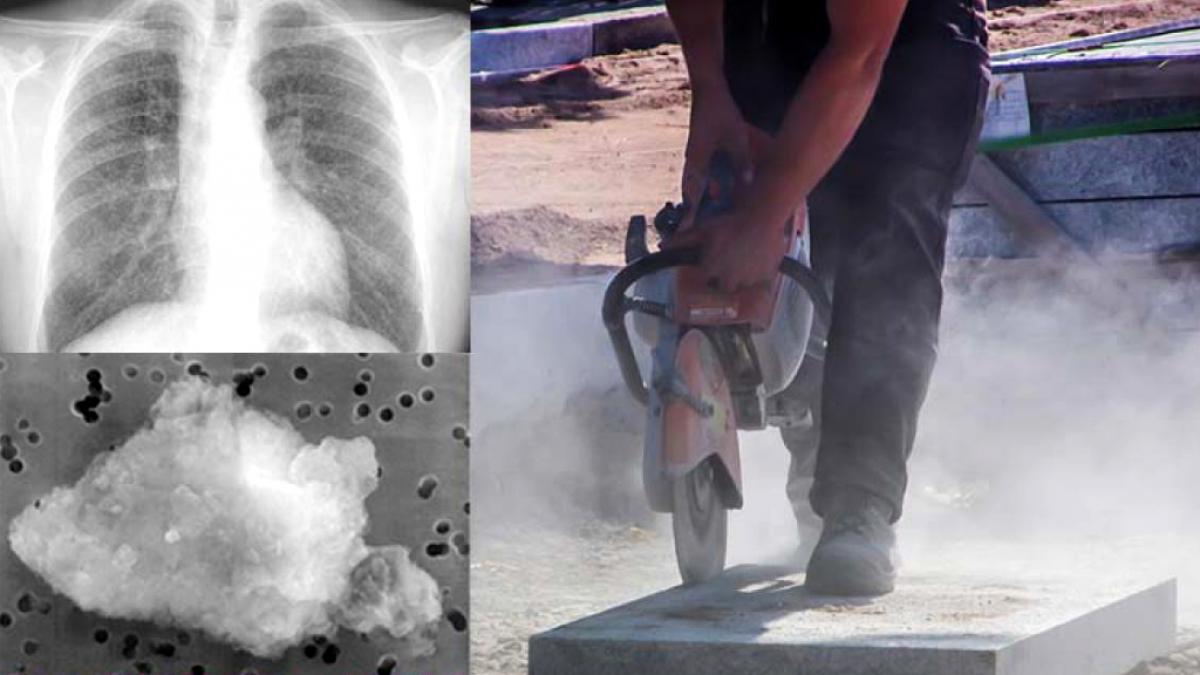 España sufre una reemergencia de la silicosis